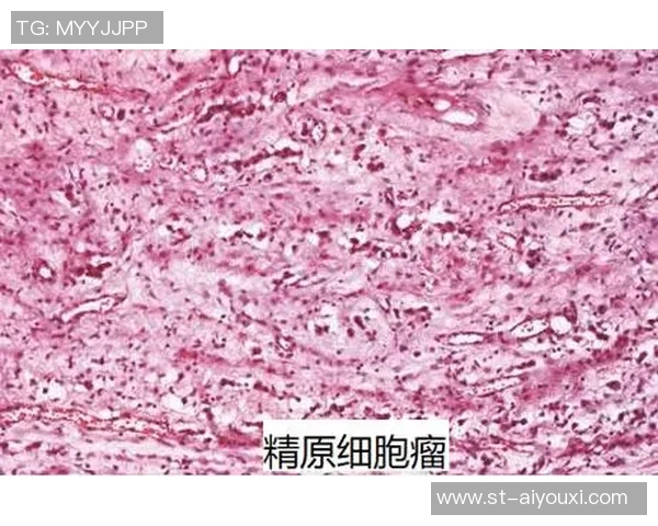 保加利亚传奇佩内夫被紧急送往肿瘤医院治疗,他曾患有睾丸癌 保加利亚传奇佩内夫被紧急送往肿瘤医院治疗,他曾患有睾丸癌